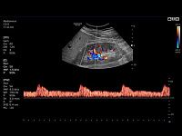 Samsung Medison HS30 Samsung Medison HS30