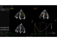 Samsung Medison V8 Samsung Medison V8