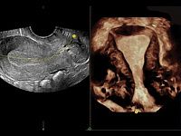 УЗИ аппарат General Electric Voluson E8