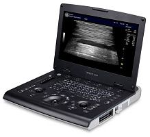 УЗИ аппарат General Electric Versana Active