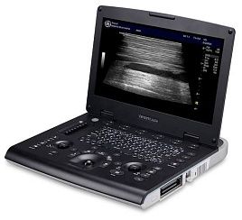 УЗИ аппарат General Electric Versana Active