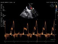 Samsung Medison V8 Samsung Medison V8