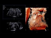 Samsung Medison W10 Samsung Medison W10