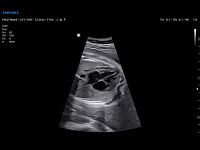 Samsung Medison V6 Samsung Medison V6