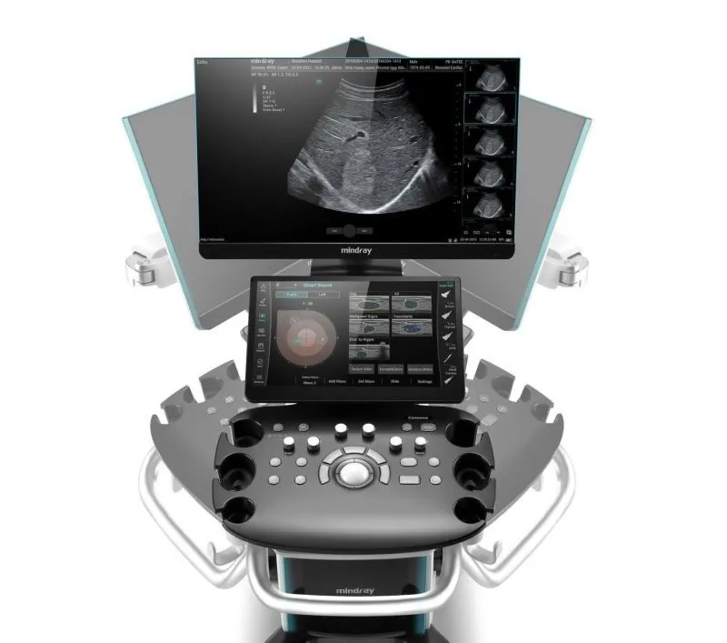 УЗИ Аппарат Mindray Consona N9