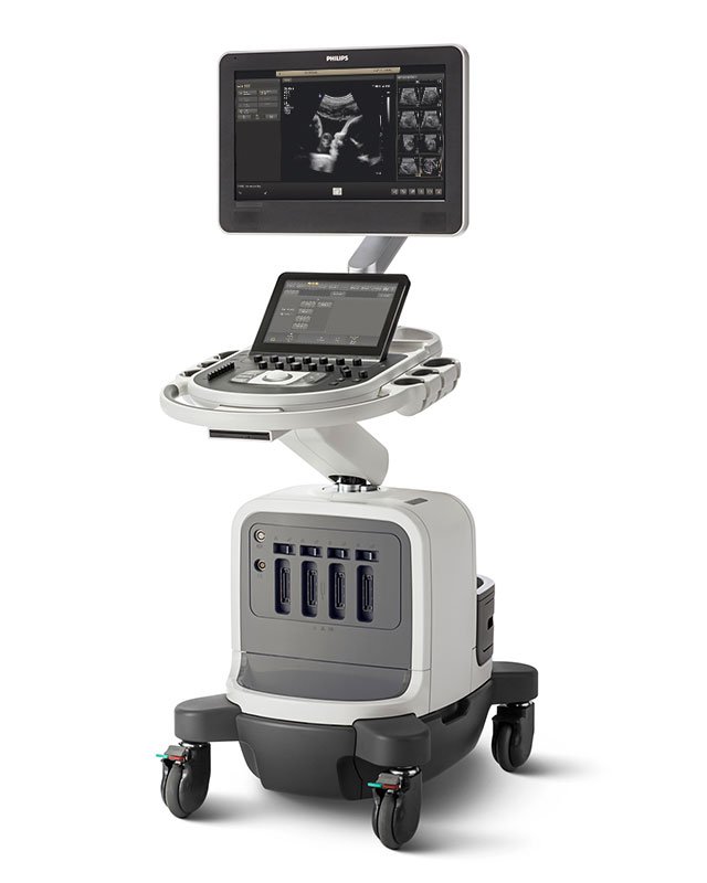 УЗИ аппарат Philips Affiniti 70 УЗИ аппарат Philips Affiniti 70